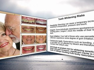 smile makeover, hollywood smile, ideal smile, colorado spri