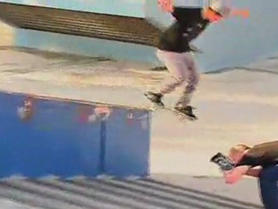 Dallas Rockvam Cuts and Bruises