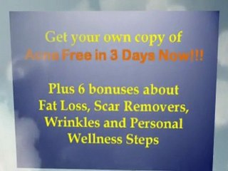 Acne No More: Keep It Simple