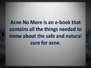 Acne No More: No Acne, So Easy