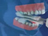 Whiter Teeth 30 Second Smile