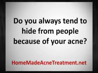 Acne No More: For A Smooth Flawless Skin