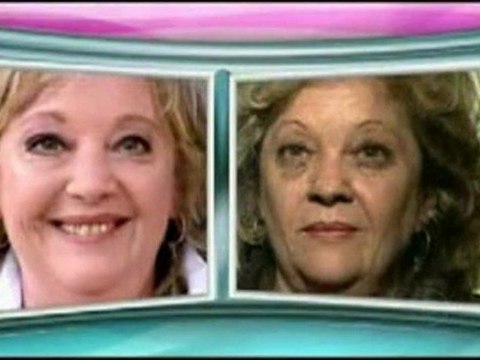 PEELING FENOL : Programa Ana Maria Braga e peeling fenol