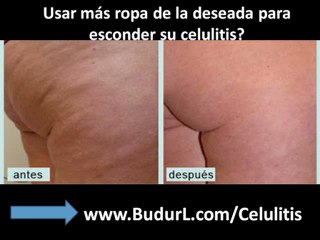 Tratamiento casero para Eliminar la Celulitis