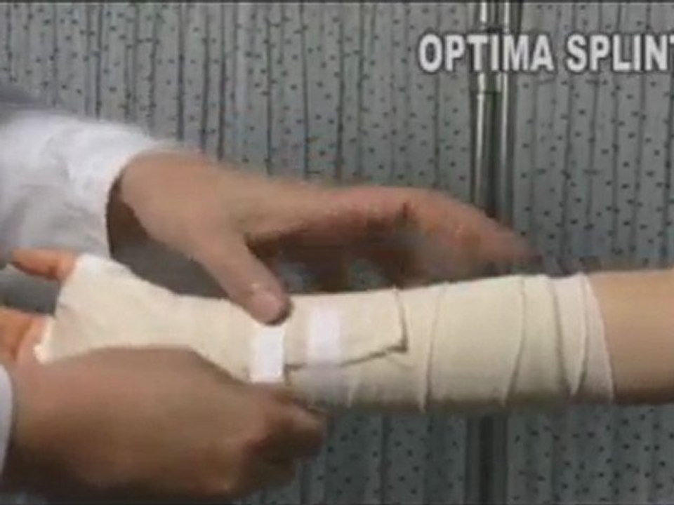 Join Enterprise's optima splint