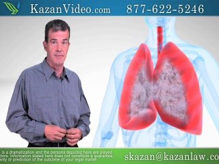 Peritoneal Mesothelioma Disease in San Diego Options - Video