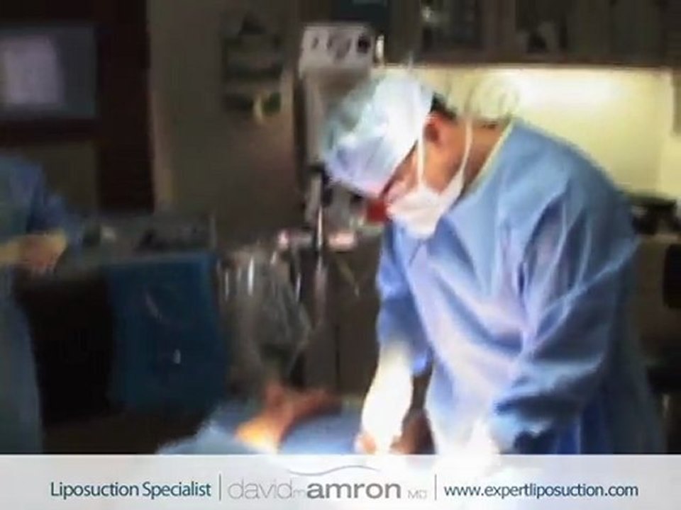 Inner Thigh Liposuction
