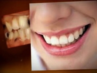 Cosmetic Dentist Winchester: Considered A Smile Makeovers