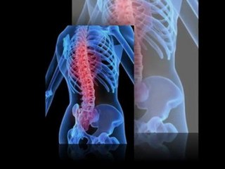 Surgical Spine Solutions