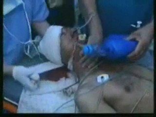 MURAT ODUNCU.(HATTAB).EY ACI