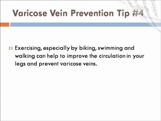 10 Tips to Varicose Vein Prevention