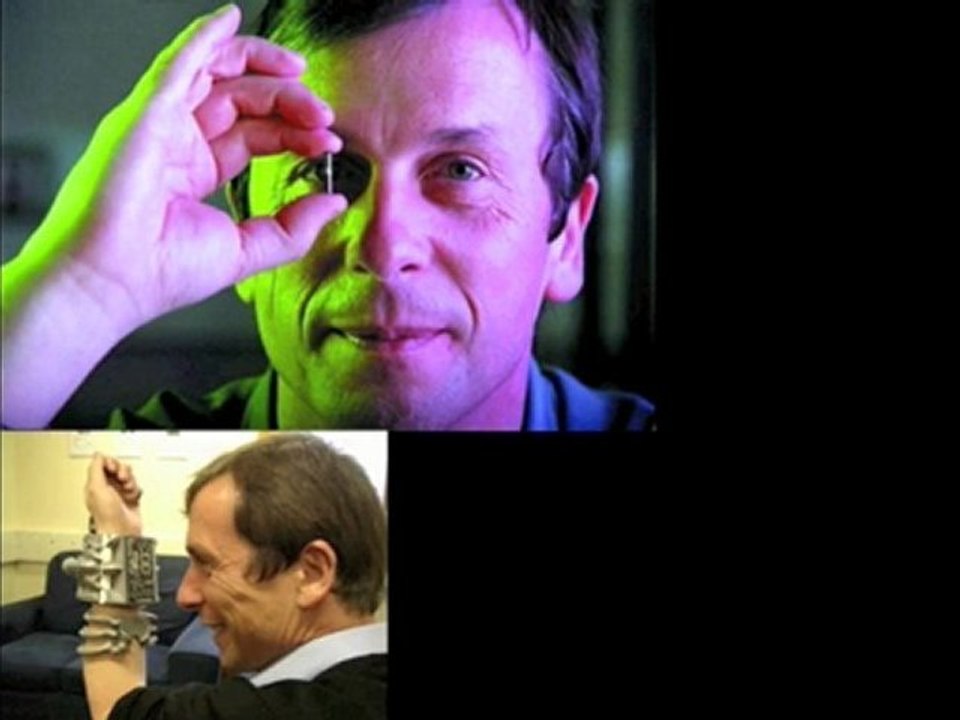 transhumanisme