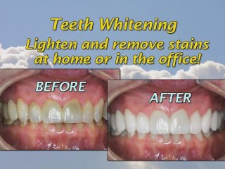 Valparaiso Family, General and Cosmetic Dentist (Chicago are