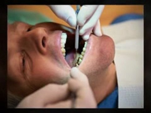 Michigan Cosmetic Dentist