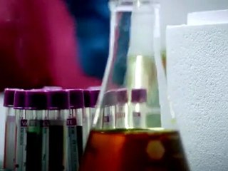 Atakan Ilgazdağ - Hiç Olmazsa (2011) by GonulAdami