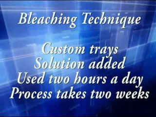 Best Cosmetic Dentist In Virginia Beach & Norfolk VA 888-29