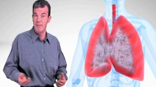 Pioneers of Mesothelioma Research in California Can Help You