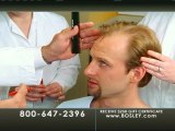 Bosley the Hair Restoration Experts pt2