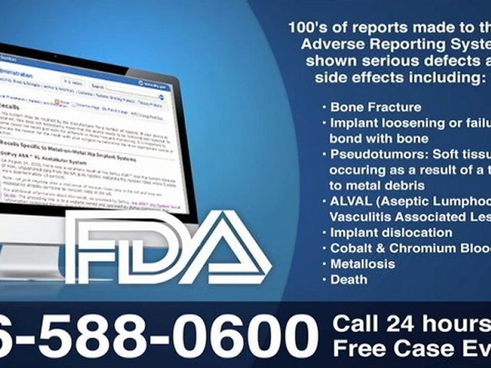 DePuy Hip Recall