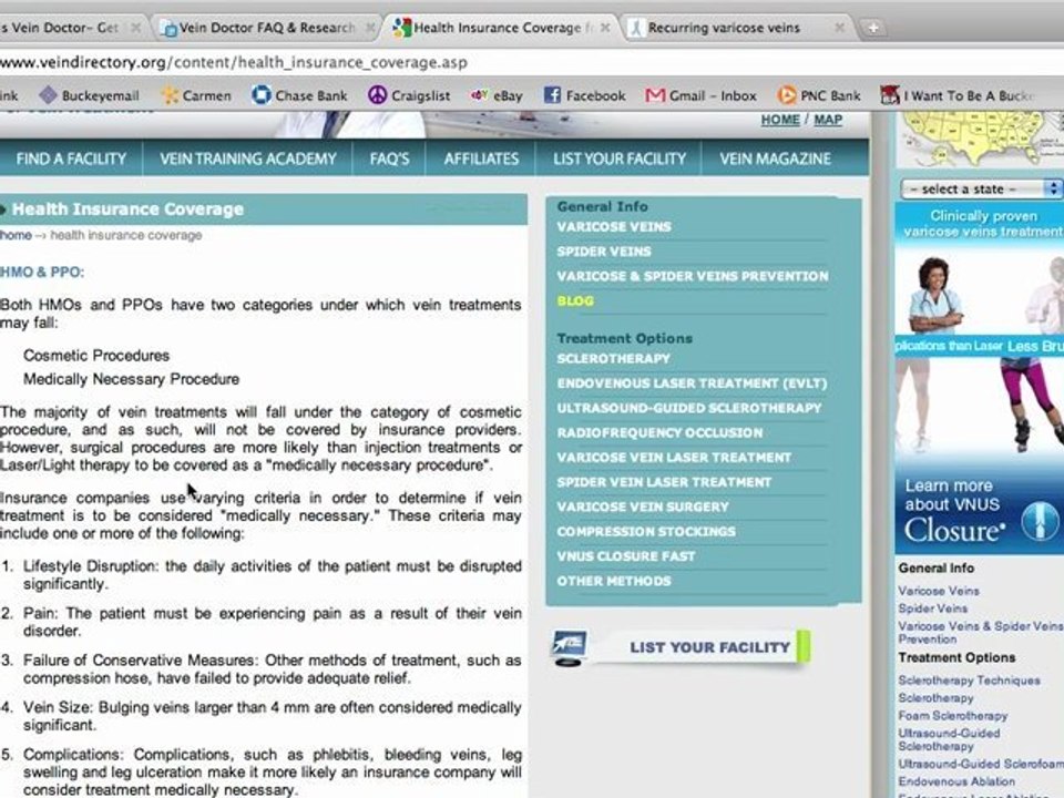 Varicose Vein Doctor Consultations and Information