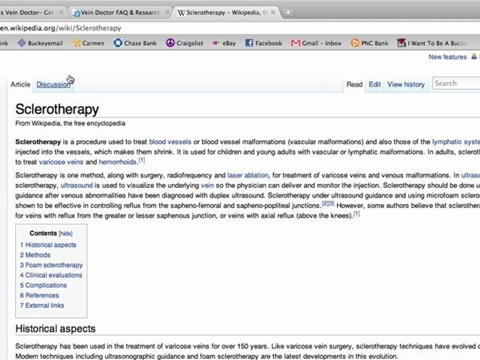 Varicose Vein Doctor Consultations and Information