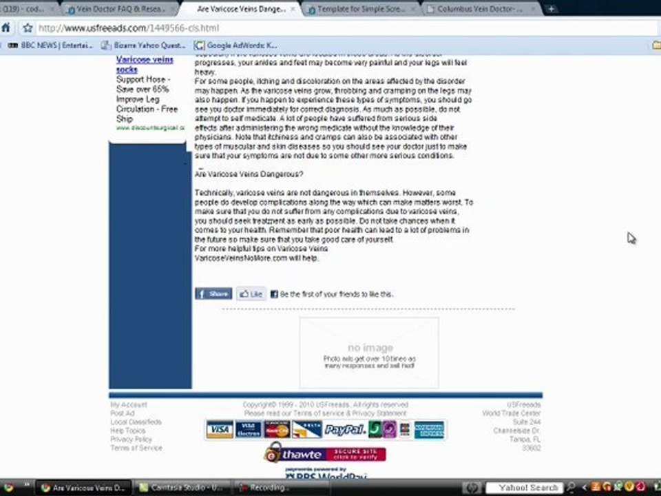Varicose Vein Doctor Consultations and Information