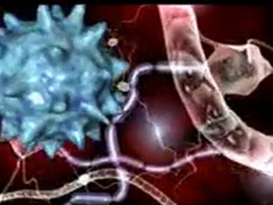 multiple sclerosis cures