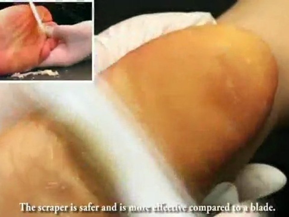 Welcalm Spa Solution's Foot Care  by Korea medical