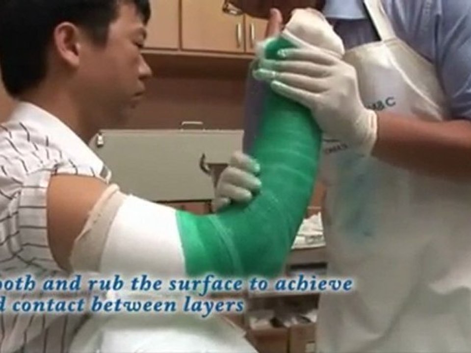 Tomato M&C Co. Ltd's arm cast tutorial part 2