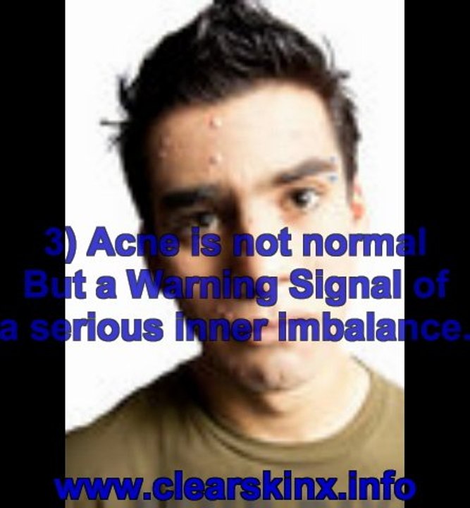 acne cure book