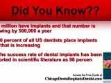 Chicago Dental Implants, Choosing Dental In Chicago