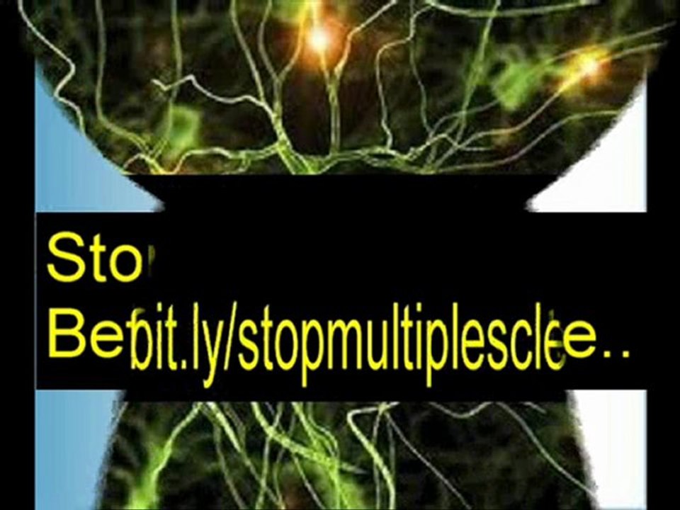 multiple sclerosis cures