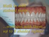 Washington DC Dentist & Prosthodontist: Dr. Neil Starr, DDS
