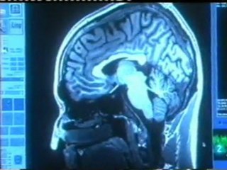 Neuromarketing: Presente y futuro