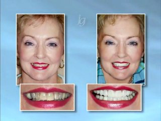 Cosmetic Dentist Saskatoon - Before and After