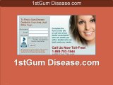 Gum Disease Dentist for Swollen Gums