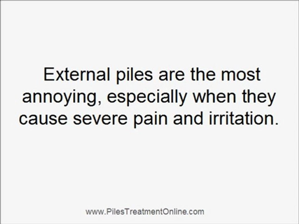 What Are Piles? - Understand What Piles Are And A Fast Cure
