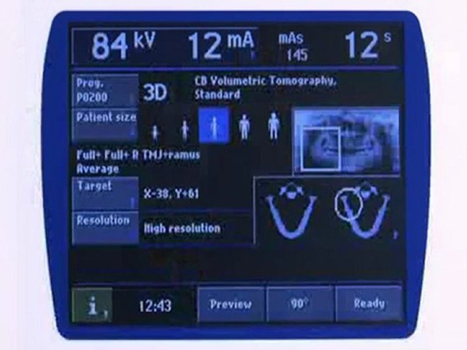 Promax 3D - Colocación Dcha de TMJ