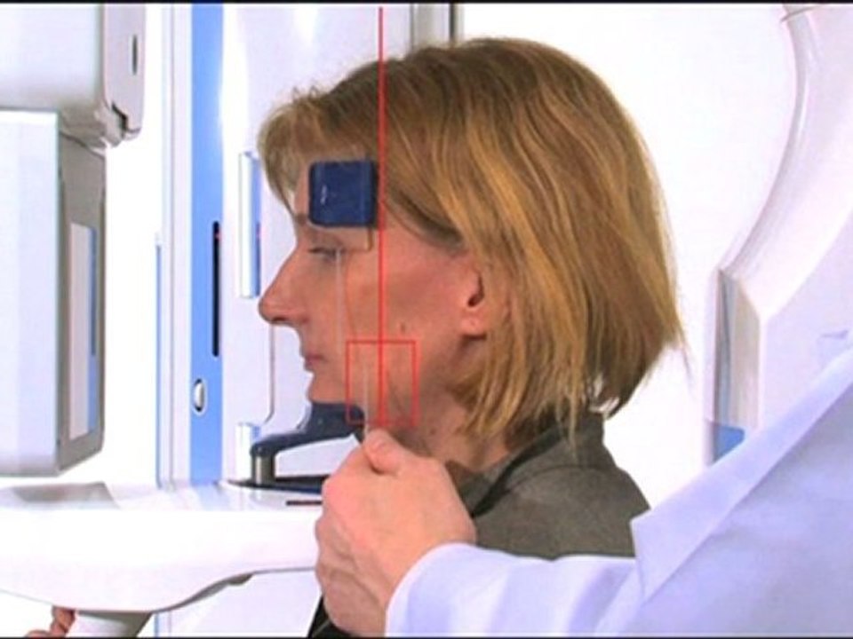 Promax 3D - Colocación Exacta en Premolares