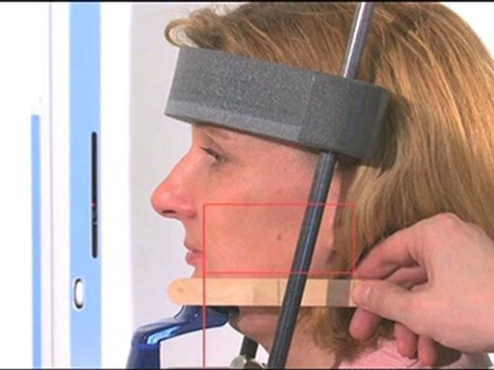 Promax 3D - Max-Colocación del Maxilar