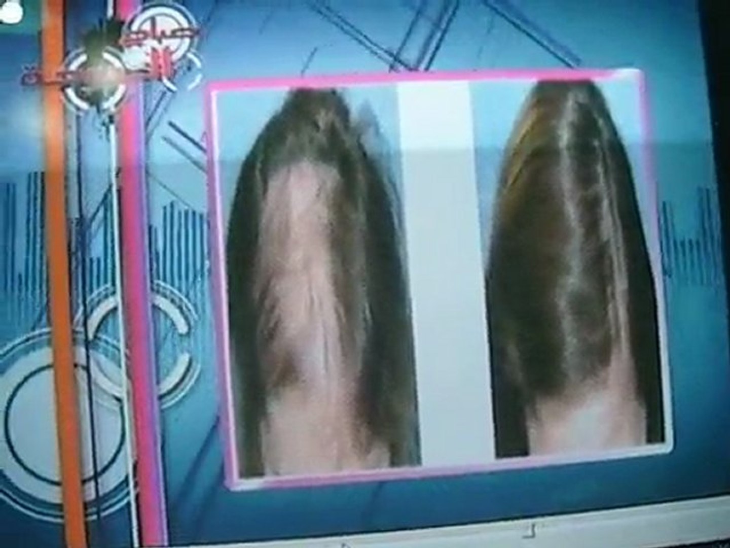 plastic surgery in qatar
