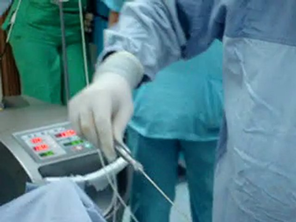 laser liposuction-dr. kamal al husseiny-qatar