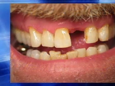 Virginia Beach Cosmetic Dentist Dr. Kent 888-297-8217