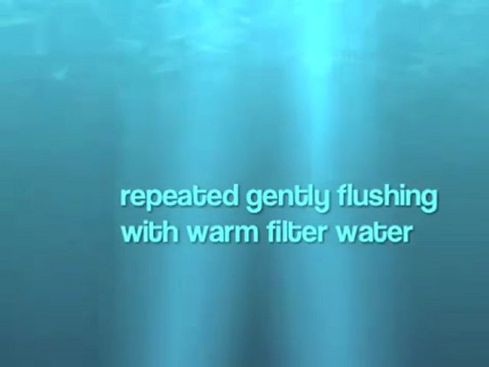 Colon Hydrotherapy Torrance Colonics (310) 846-7221