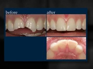 Best Bend Dentist|Family and Cosmetic dentistry