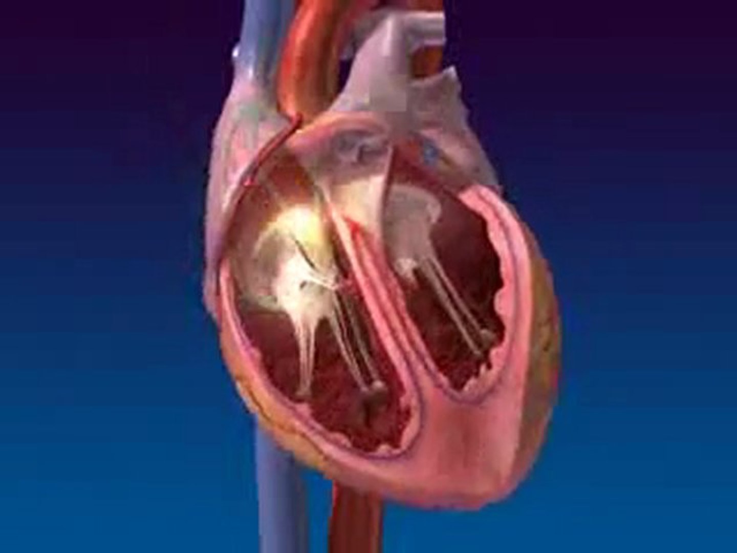 Argosy Medical Animation Sectioned Heart - video Dailymotion