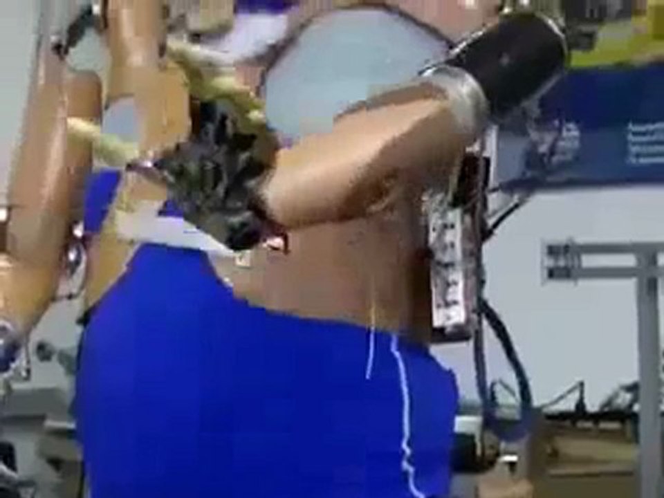 Cutting Edge Prosthetic Arms