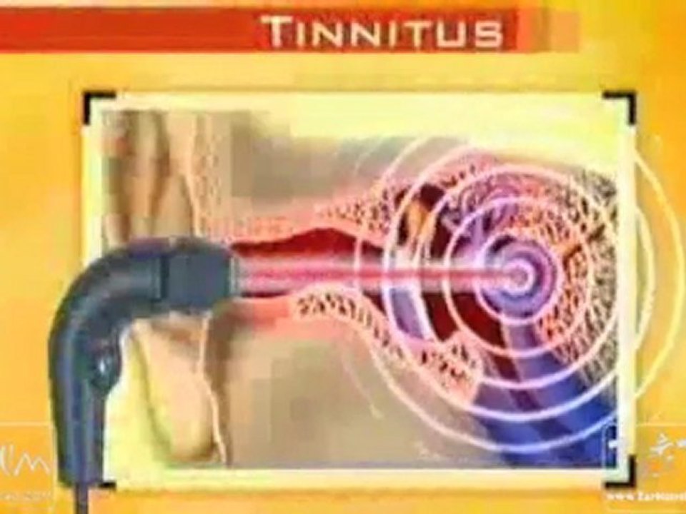 Tinnitus Behandlung