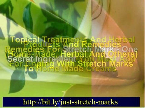 stretch marks remove - what are stretch marks – stretchmarks