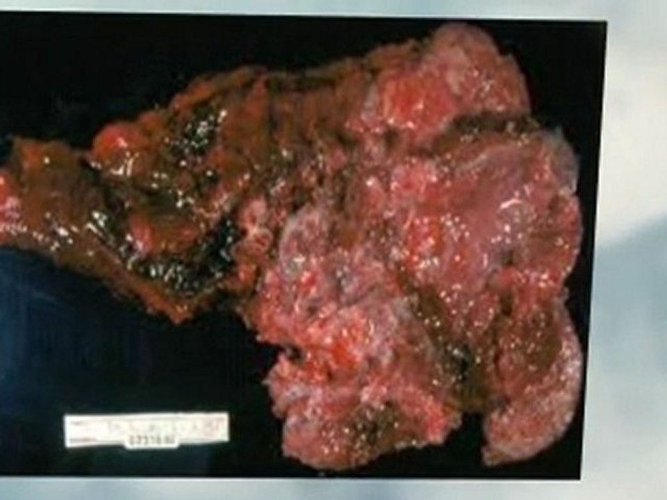 Asbestos Abatement Indio